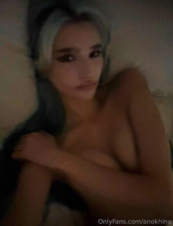 🔥 Anokhina liza page leaked private photo uncensored full