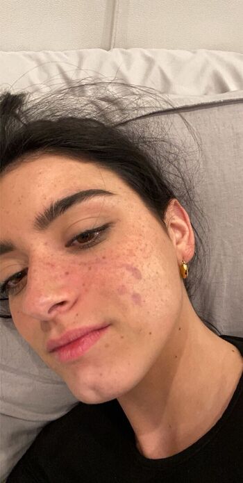 🔥 Dixie d amelio page leaked private photo uncensored full
