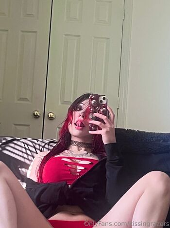 🔥 Killkels page leaked private photo uncensored full