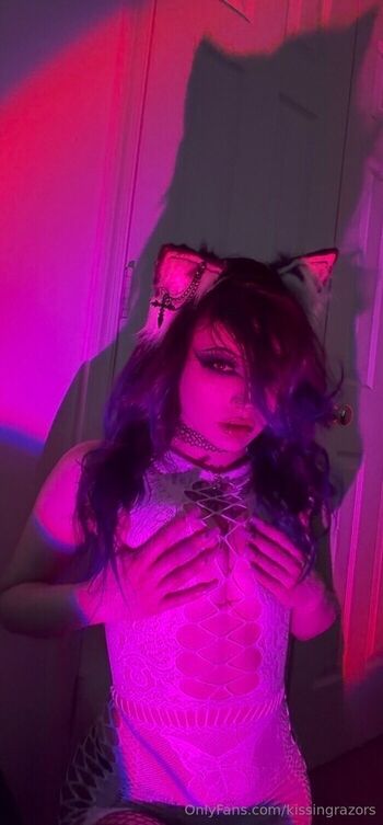 🔥 Killkels page leaked private photo uncensored full
