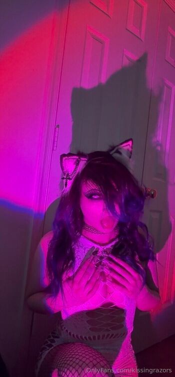 🔥 Killkels page leaked private photo uncensored full