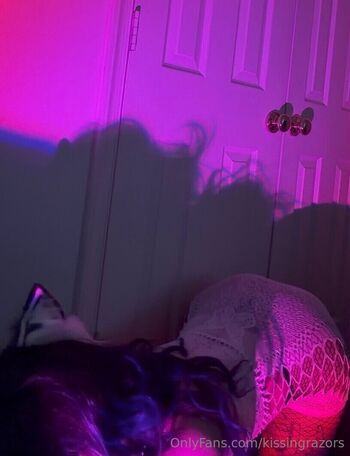 🔥 Killkels page leaked private photo uncensored full