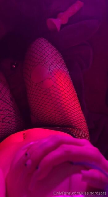 🔥 Killkels page leaked private photo uncensored full