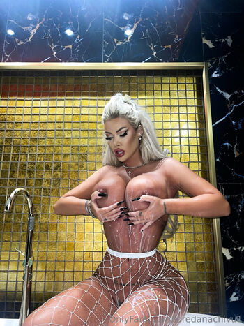 🔥 Loredana chivu page leaked private photo uncensored full