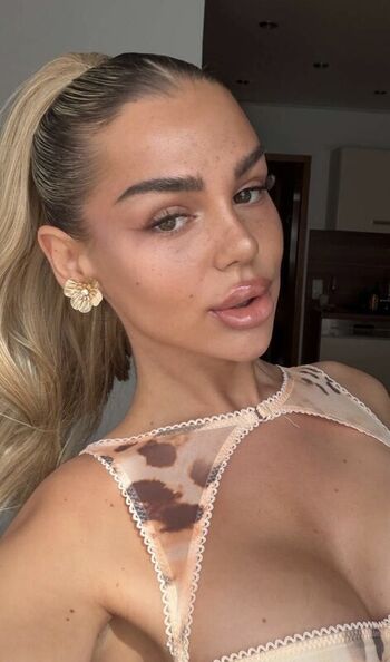 🔥 Milaneedls leaked private photo uncensored full