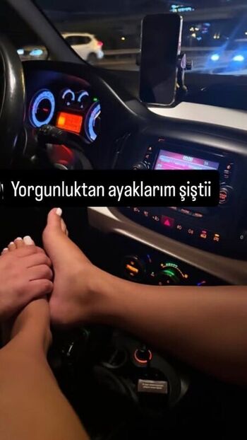 🔥 Mylife  page leaked private photo uncensored full