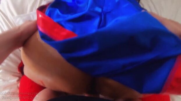 🔥 Npczoey leaked private photo uncensored full