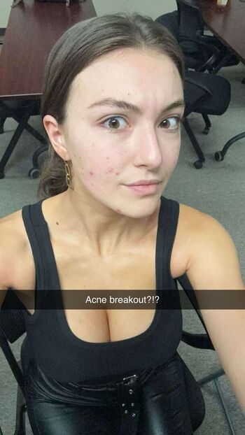 🔥 Rachel michelle leaked private photo uncensored full