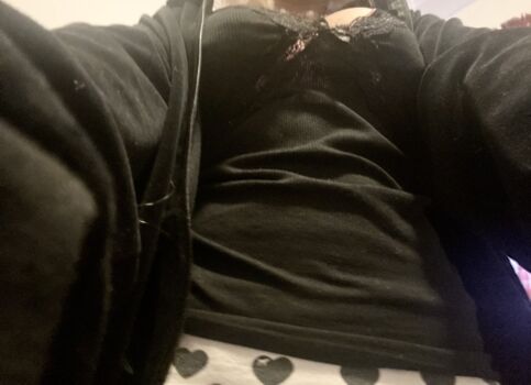 🔥 Vileautopsy leaked private photo uncensored full